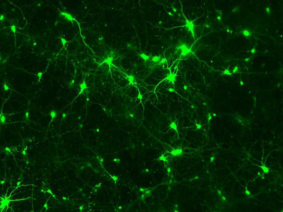 NEPA21 / Primary - Mouse Cerebral Cortex Neurons - Transfection Efficiency 70 per cent